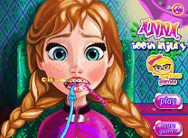 Anna Probleme cu Dintii