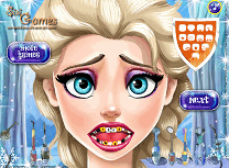 Elsa Probleme cu Dintii