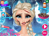 Elsa Tratament cu Lipitori