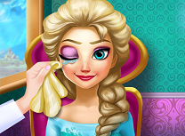 Elsa Tratament la Ochi