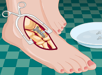 Implanteare Tija in Picior