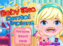 Micuta Elsa Implant Dentar