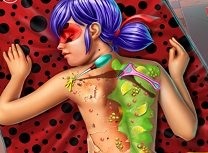 Buburuza Tratament de Spate